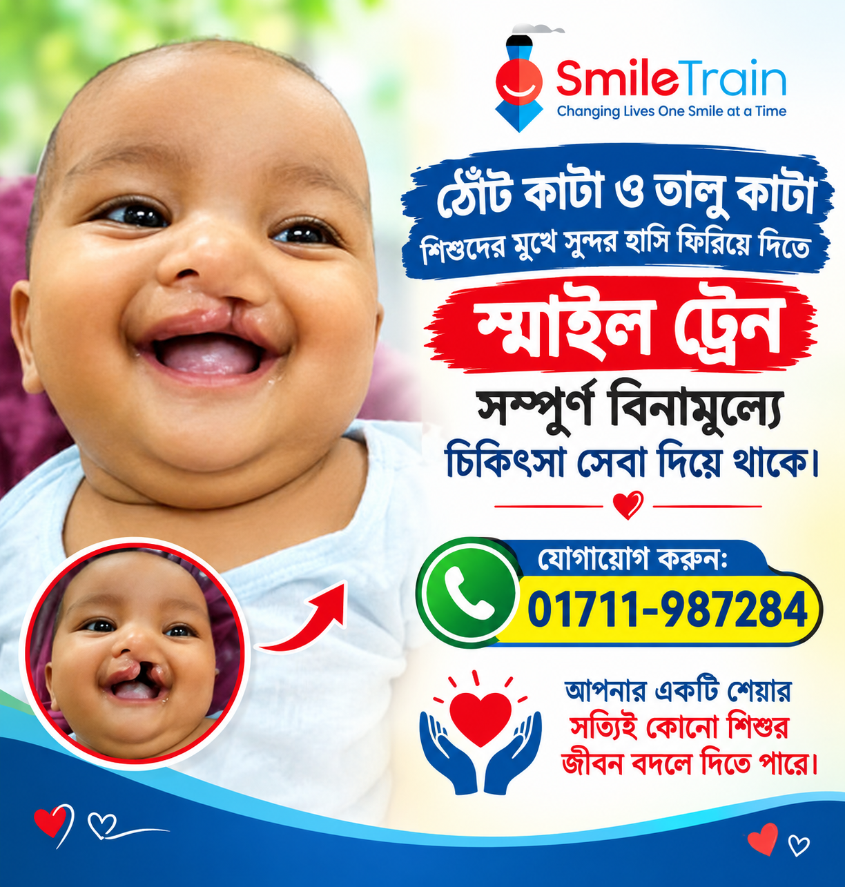 Advertisement